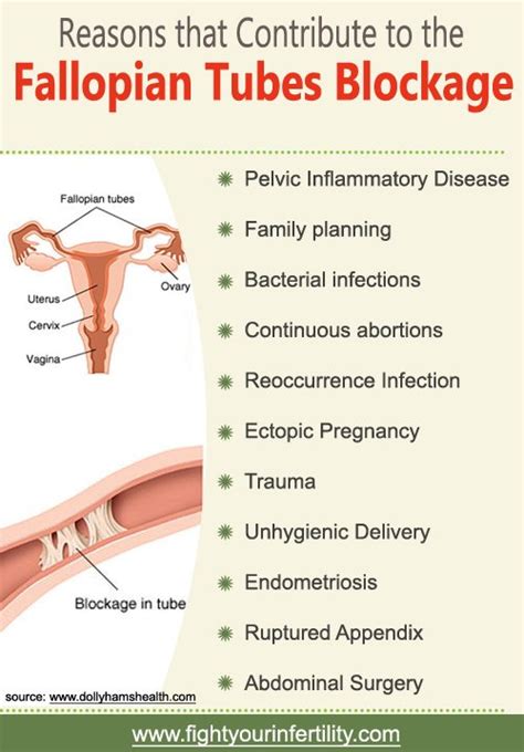 Is Ivf The Only Option For Blocked Fallopian Tubes