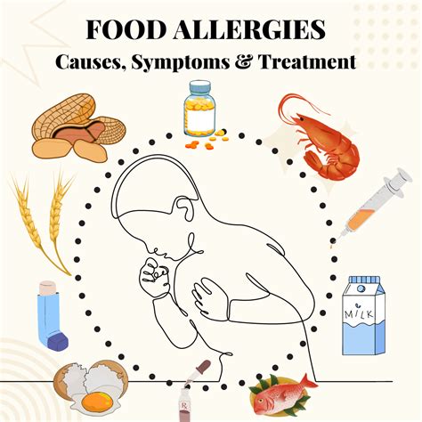 Food Allergies What You Need To Know By Sundas Sarwar