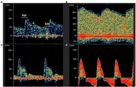 Frontiers Multimodal And Autoregulation Monitoring In The