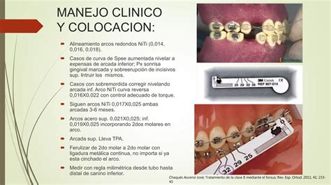 Ortodoncia Clinica Forsus PPT