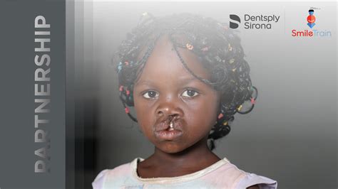 In Anticipation Of World Smile Day Dentsply Sirona And DS World 2021