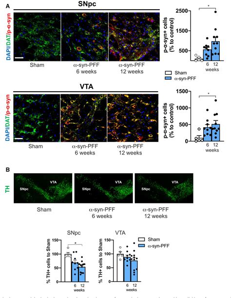 Figure 2 From Dopamine Dependent Early Synaptic And Motor Dysfunctions