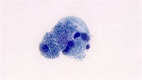 Histoplasma Capsulatum Histology