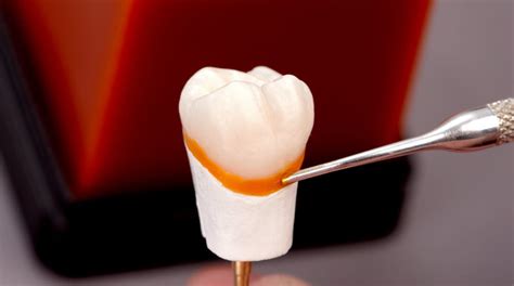 La Gu A M S Completa Sobre Las Ceras Dentales Dentaltix