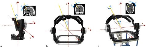 Diode Directional Orientation Detection Of Segmented Deep Brain Stimulation Leads A Sequential