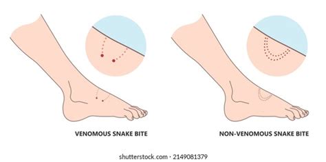 510 Snake Wound Images, Stock Photos, 3D objects, & Vectors | Shutterstock