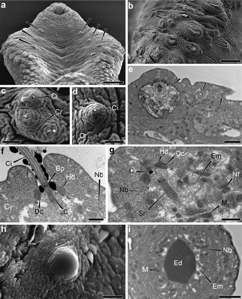 Scanning And Transmission Electron Micrographs Of The Sensory Receptors