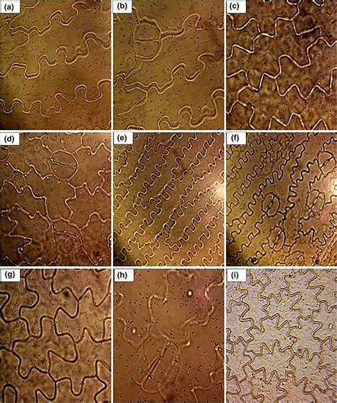 General Aspect Of Leaf Epidermis Of Pteridaceae Using Light Microscope Download Scientific