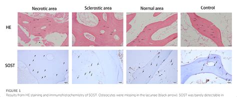 Figure From Mechanical Properties Of Trabeculae And Osteocyte