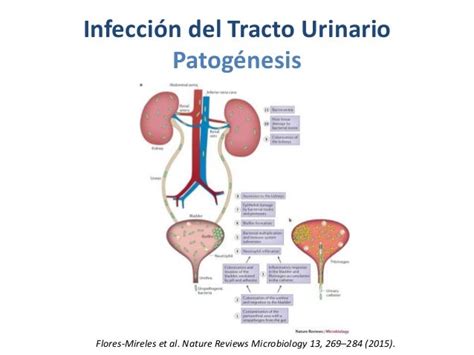 Infecciones Del Tracto Urinario