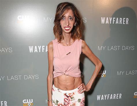 Here Is Another Reminder That World S Ugliest Woman Lizzie Velasquez Is Such An Incredible