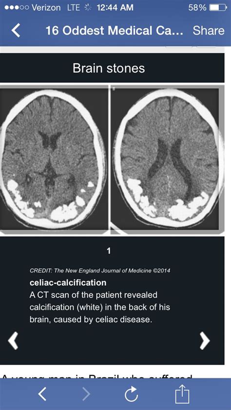 Pin By Aleksandra Stawik On Medyczne Medical Radiography Radiology