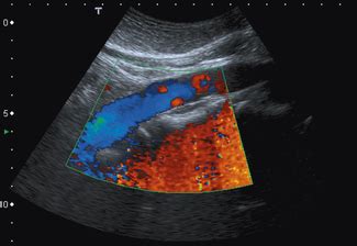 Physical Principles Of Doppler Ultrasound Radiology Key