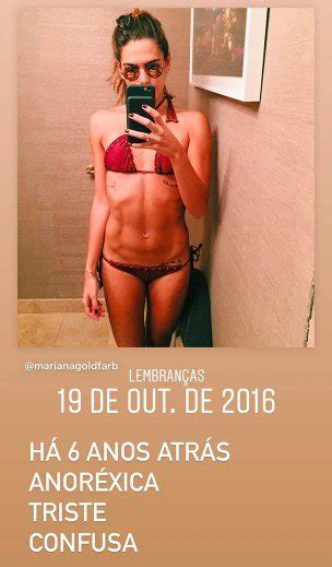 Mariana Goldfarb Fala Sobre Sa De Mental E Relembra Anorexia Metr Poles