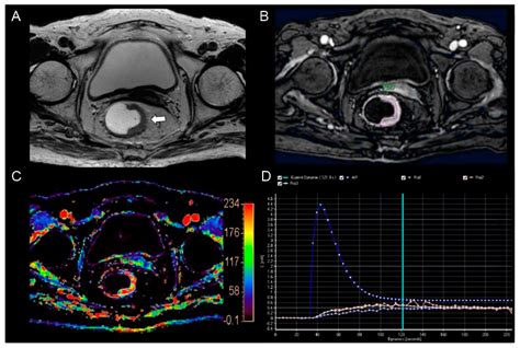 Current Oncology Free Full Text Association Between Dynamic