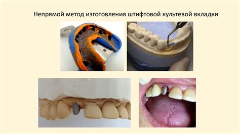 Штифтовые зубы - презентация онлайн