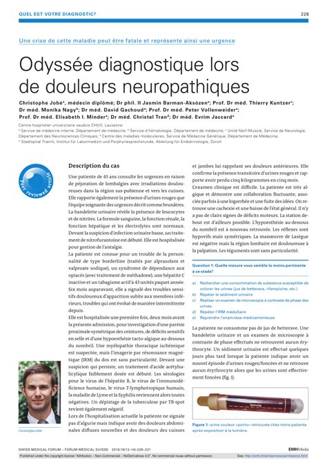 PDF Odyssée diagnostique lors de douleurs neuropathiques