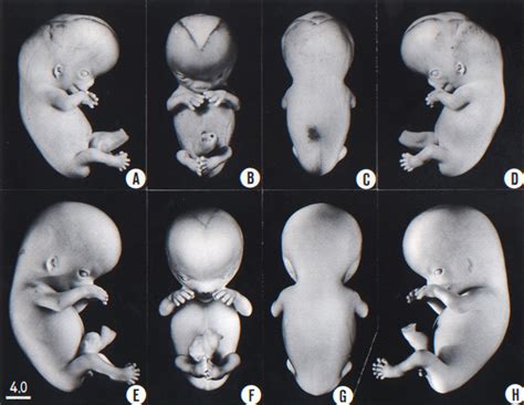 Human Embryo Development Timeline