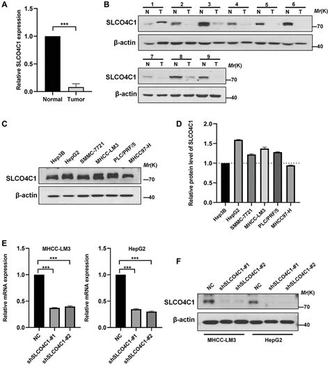 Identification And Validation Of Slco4c1 As A Biological Marker In Hepatocellular Carcinoma