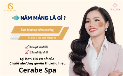 Nám Mảng Dấu Hiệu Nhận Biết Nguyên Nhân Phương Pháp điều Trị Nám