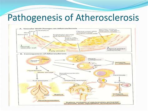 Ppt Pathophysiology Of Atherosclerosis Powerpoint Presentation Free