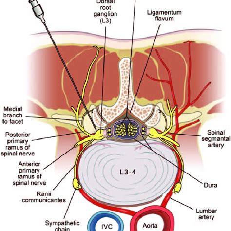 Posterior-anterior view of the cervical spine during C7/T1 ...