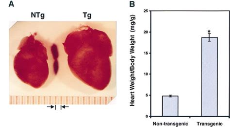 Figure 3 From Cardiomyopathy In Transgenic Mice With Cardiac Specific