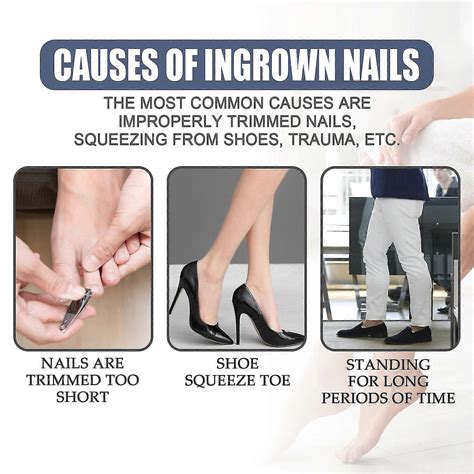 West&Month Ingrown Toenail Relief Oil Repair Ingrown Toenails