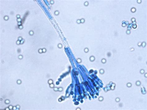 Penicillium Microscope