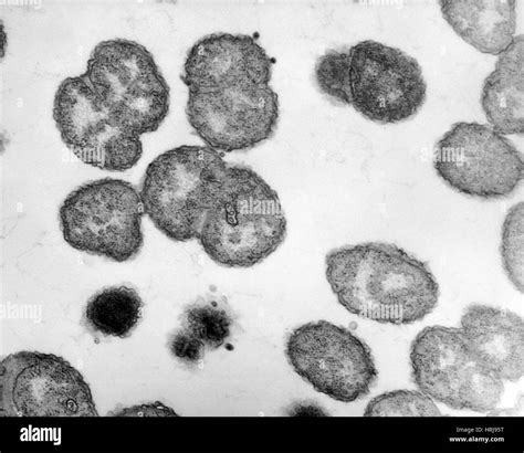 Neisseria Gonorrhoeae Bacteria Em Stock Photo Alamy