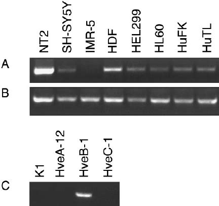 Susceptibility Of Hveb Expressing Cho Cells To Hsv Bhv And Prv