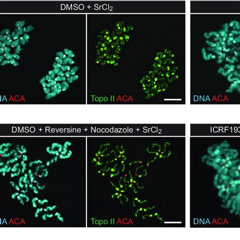 The Effect Of Topo Ii Inhibition On Sister Centromere Separation In