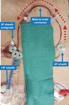 Femoral Sheath