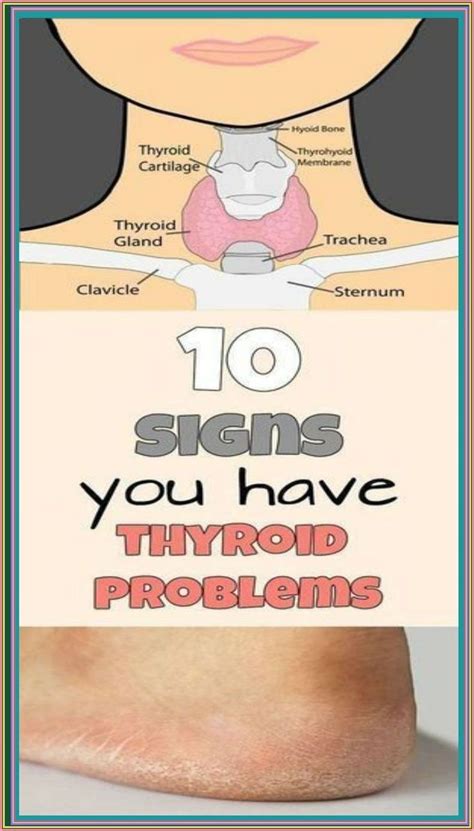 10 Signs You Have A Thyroid Problem And 10 Solutions For It Artofit