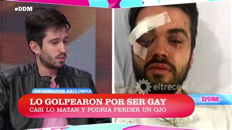 Un joven fue atacado por ser gay Habla el amigo que presenció el hecho YouTube