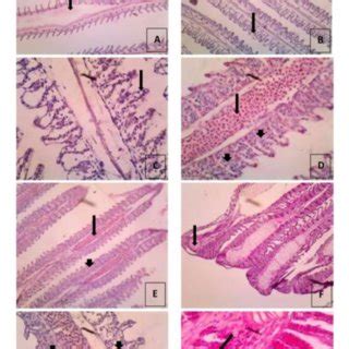 Histopathological Changes Observed In The Gills Of Tilapia Exposed To