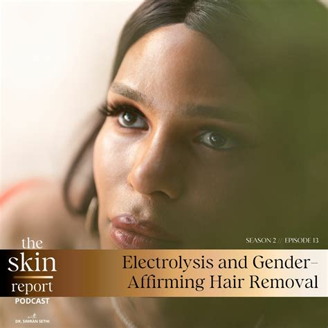 Season 2 Episode 13 Electrolysis And Gender Affirming Hair Removal