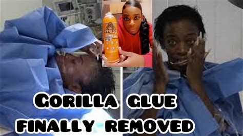 Tessica Brown Aka Gorilla Glue Girl Update Glue Removed Youtube