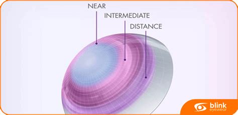 Are Multifocal Contact Lenses For Presbyopia The Ultimate Solution