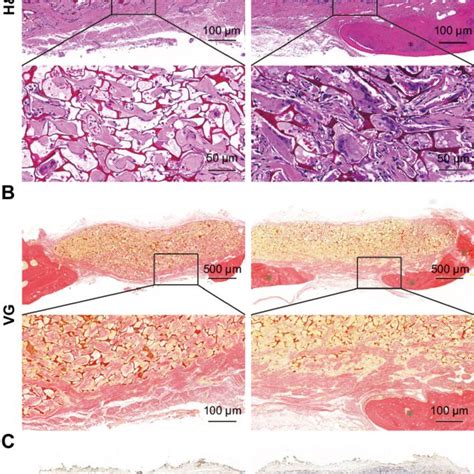 Histological Analysis Of Cranial Bone Defects Notes A Hande B Vg Download Scientific