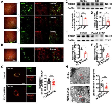 Figure 3 From Pdzd8 Mediated Endoplasmic Reticulummitochondria