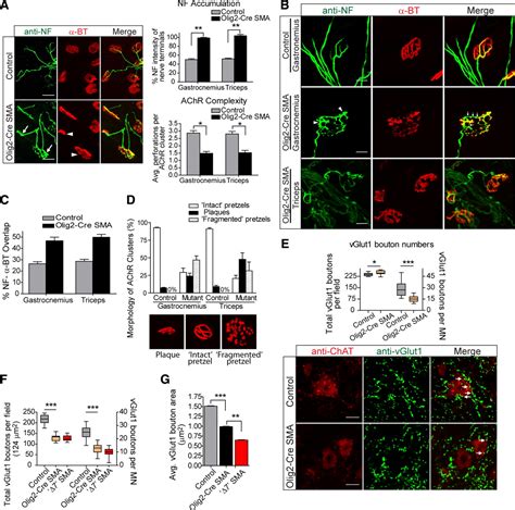 Reduced Survival Of Motor Neuron SMN Protein In Motor Neuronal