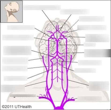 L Neuro Block Cerebrovascular Anatomy Trauma Diagram Quizlet