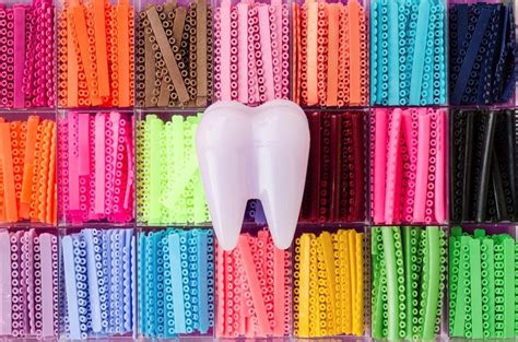 Best Braces Rubber Band Colors Warehouse Of Ideas