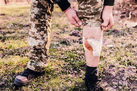 Premium Photo | Man is putting bandage on bleeding wound Injured leg ...