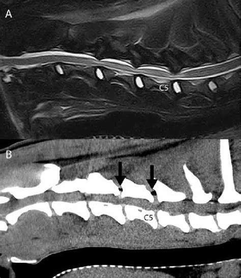 A Fse T2 Sagittal 025t Mr Image And B Soft Tissue Algorithm Sagittal