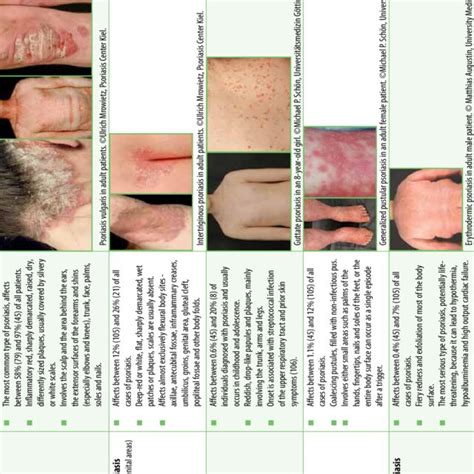 Common Types Of Psoriasis And Their Manifestations Download Scientific Diagram