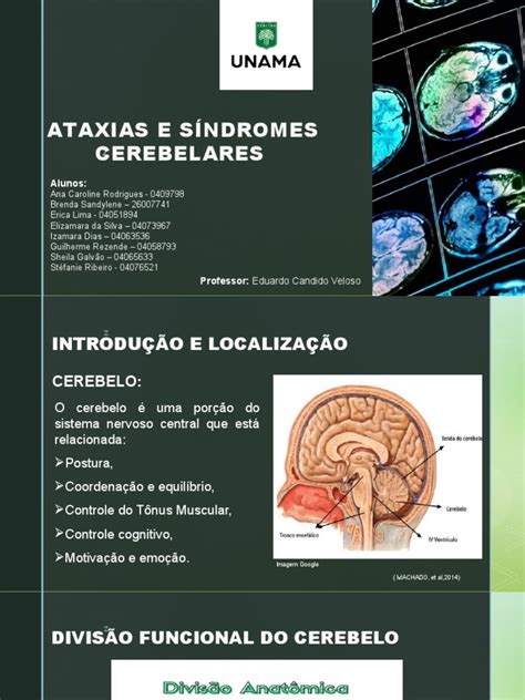 O Que É Ataxia Cerebelar - Ataxias e Síndromes Cerebelares | PDF | Cerebelo | Medicina Clínica