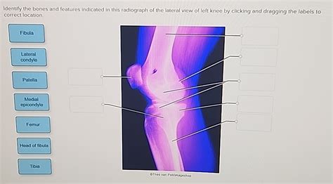 Solved Identify The Bones And Features Indicated In This Chegg