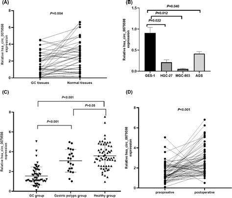 Hsa Circ Acts As A Potential Diagnostic And Prognostic